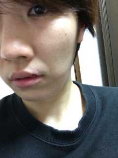 あとひとおし